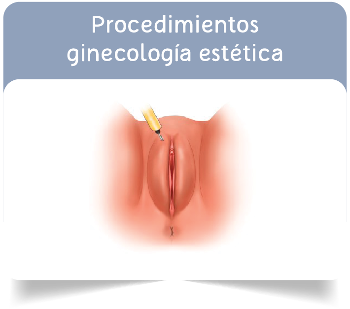 Procedimientos  Ginecologia Estetica Bogota